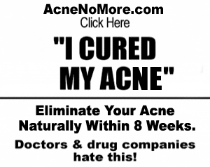 Acne Diet Link Exposed: Is There An Acne Cure Diet That Works?